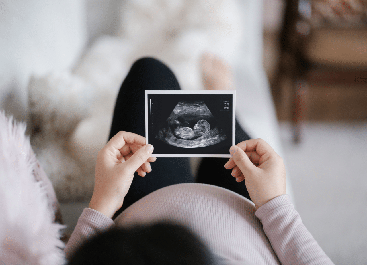 A pregnant women lays on the couch and looks at an ultrasound