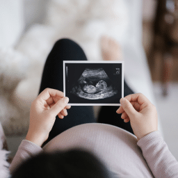 A pregnant women lays on the couch and looks at an ultrasound